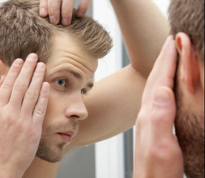 Take Back Your Hairline: Proven Hair Growth Solutions for Men's Hairloss