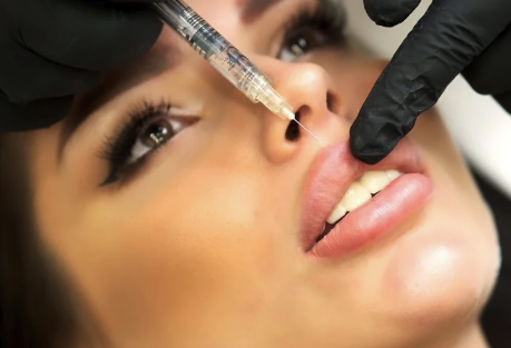 Lip Flip vs. Filler: Which Is Right for You?
